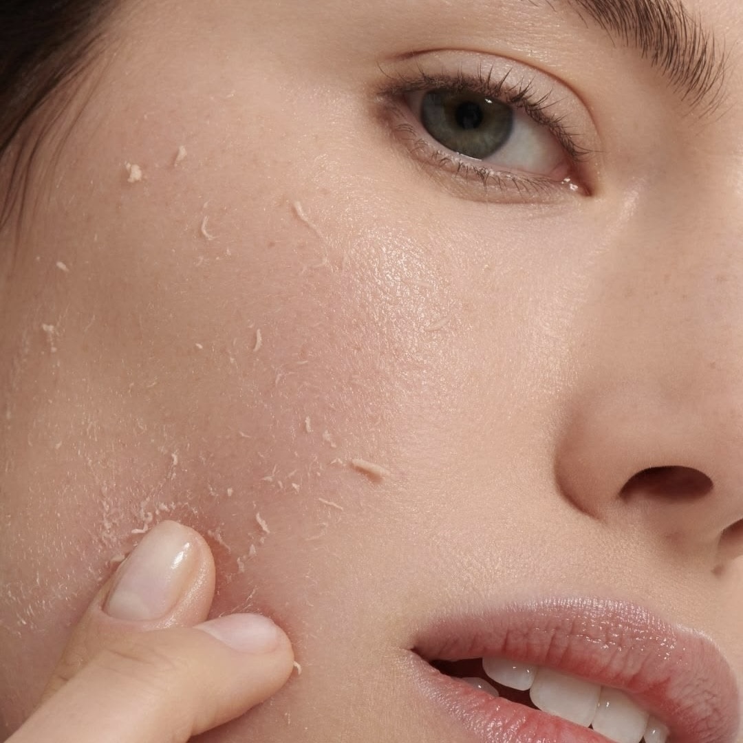 Peeling
